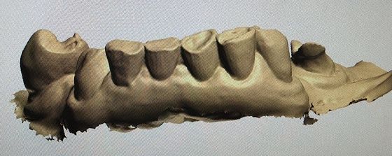 3D Digital Mock Up Teeth Other Dental Products