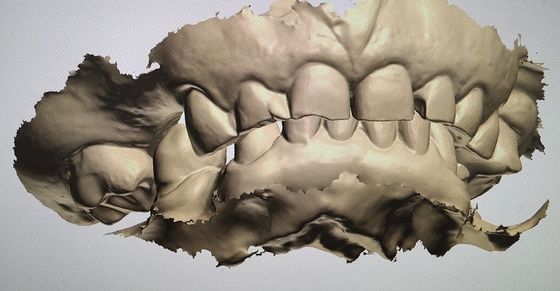 CAD CAM Design Digital Display Mockup Teeth Other Dental Products