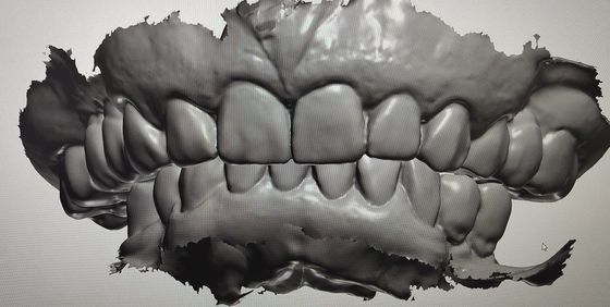 CAD CAM Design Digital Display Mockup Teeth Other Dental Products
