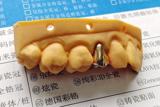 High Noble Gold Full Metal Dental Crown