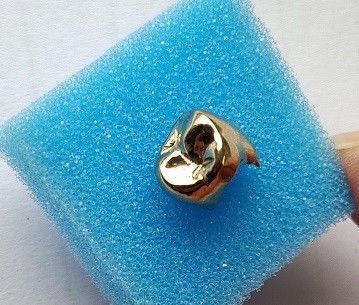High Noble Gold Full Metal Dental Crown