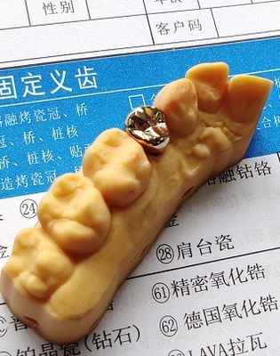 Good Fitness High Precious Gold Alloy Dental Crown