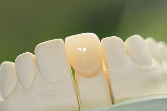 Natural Permanent Glass Ceramic Dental Crown For Anterior Teeth
