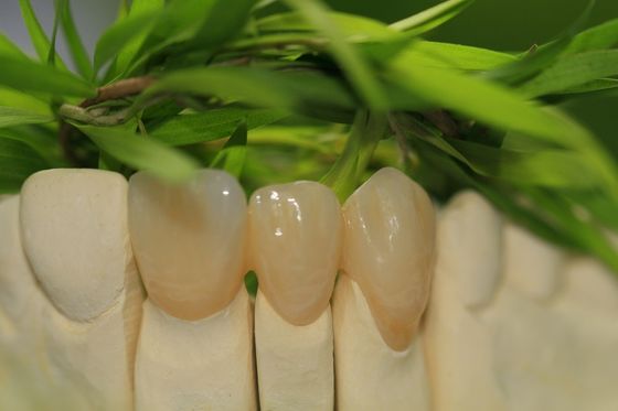 Prosthetic Dentistry Full Zirconium Oxide Crown 5 Stars Design Dental Lab