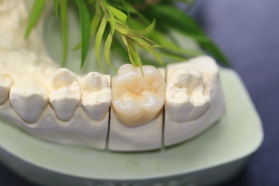 Design Dental Lab Monolithic Zirconia Dental Crown For Molars Posterior Teeth