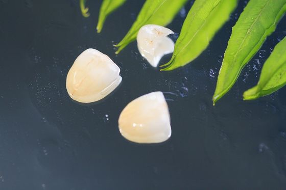Natural EMAX Dental Crown
