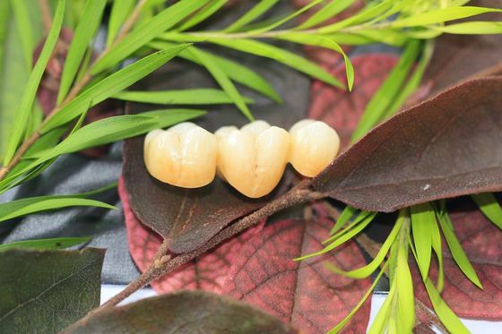 Dental Laboratory Zirconium Oxide Porcelain Zirconia Dental Crown With Ceramic