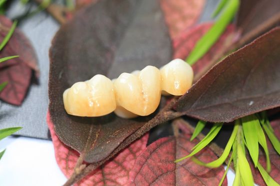 Design Dental Lab Monolithic Zirconia Dental Crown For Molars Posterior Teeth