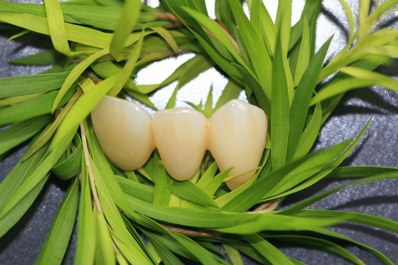 Natural EMAX Dental Crown