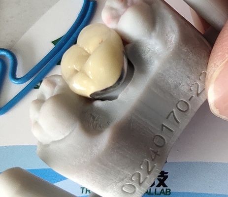 Dental Lab Product CAD CAM PFM Crown porcelain fused to metal