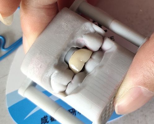 Laboratory PFM Dental Crown 3D printing Bridge Dental Crown