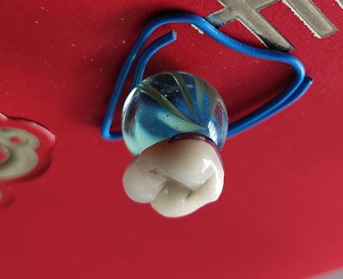 Dental Lab Product CAD CAM PFM Crown porcelain fused to metal