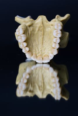Dental Lab Porcelain Zirconia Dental Crown 5 Stars Esthetics