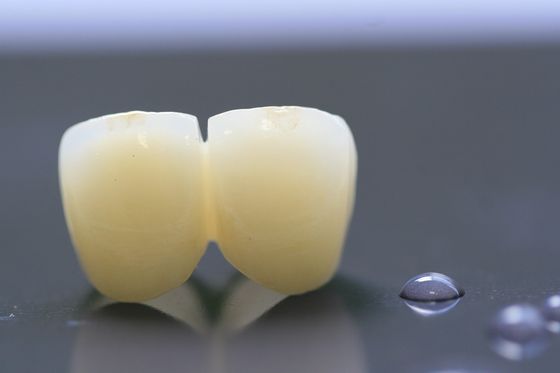 3D Print Framework PFM Dental Lab Crown For Dentistry