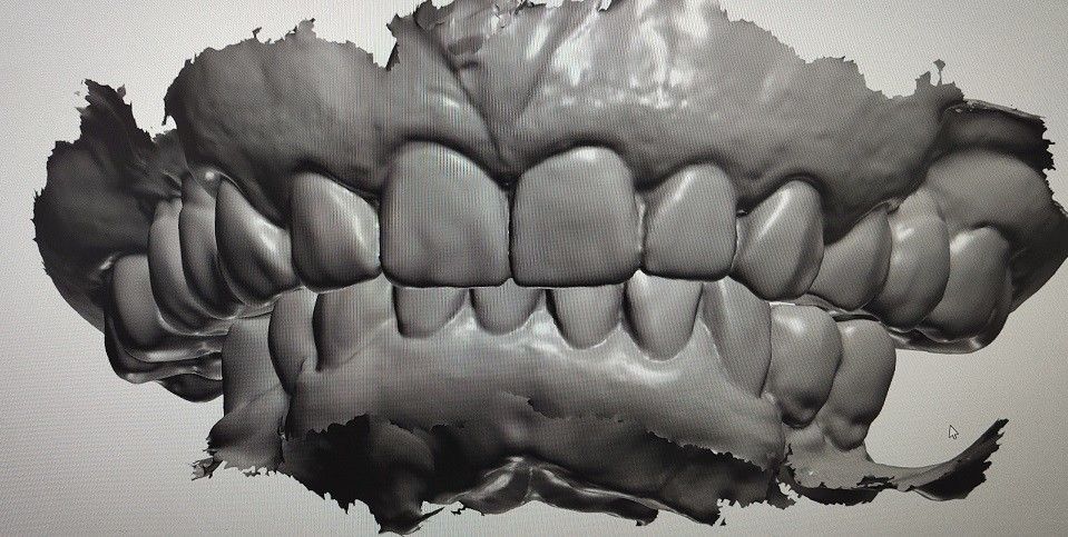 CAD CAM Design Digital Display Mockup Teeth Other Dental Products