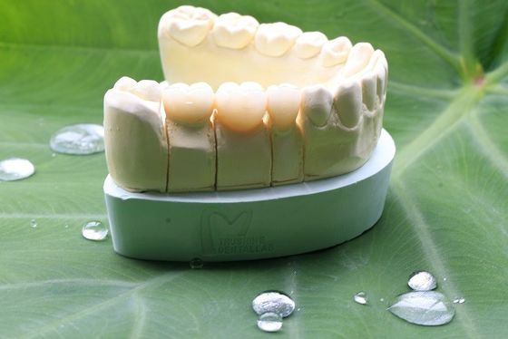 Great Biocompatibility Full Contour Zirconia Dental Crown For Dental Laboratory
