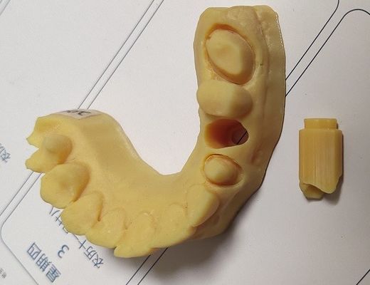 High Precision ISO13485 Trushine Dental 3D Print model